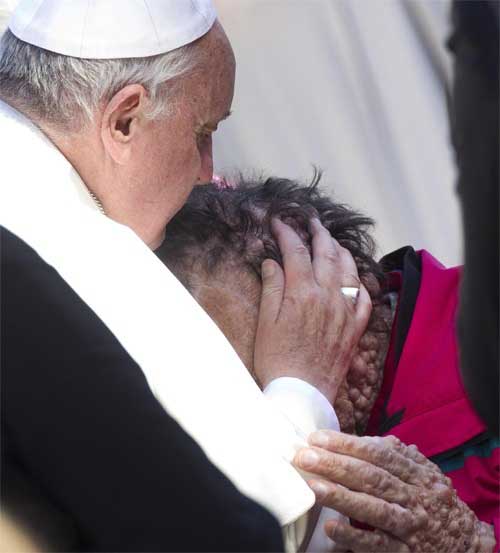 Pope Francis kisses a suffering man